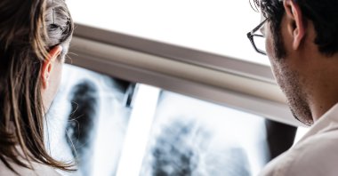 A study suggests a single bout of exercise may help against bone cancer. (Shutterstock Photo) 