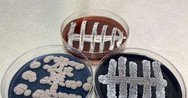 A view of petri dishes containing bacteria, in Samsun, northern Turkey, July 13, 2021. (DHA PHOTO) 