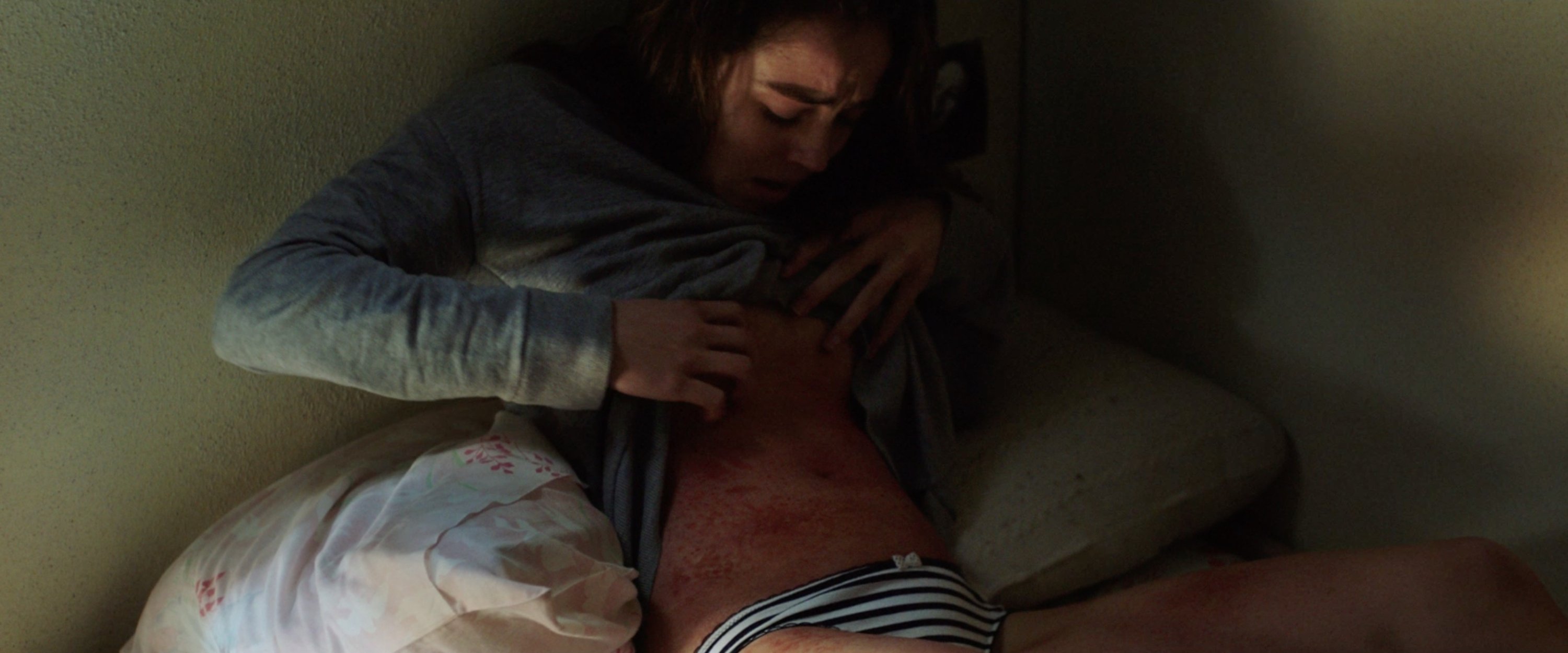 A still shot from "Raw" shows the terrible rash Justine develops after eating meat.