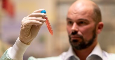 Professor David Nisbet from Australian National University (ANU) holds a vial as researchers from ANU developed a new type of hydrogel that could help to defeat Parkinson's disease, in this undated handout picture. (Reuters Photo)
