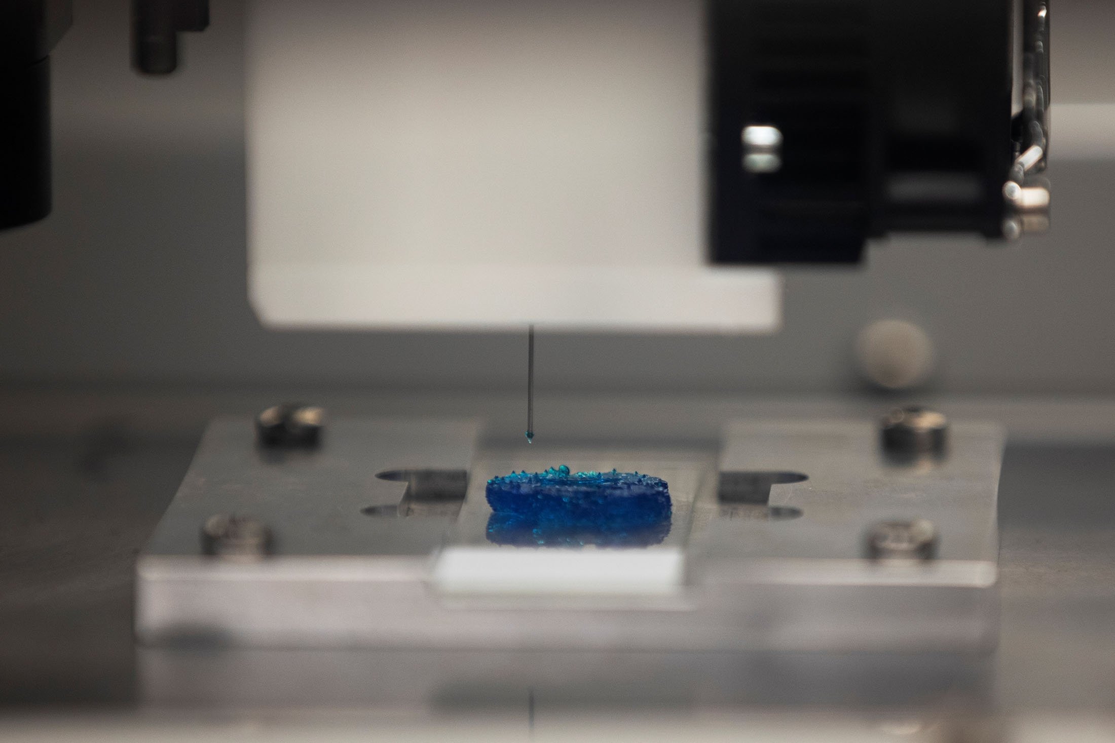 A 3D model of a tumor is made using bioprinting technology, as part of brain cancer research that uses patients