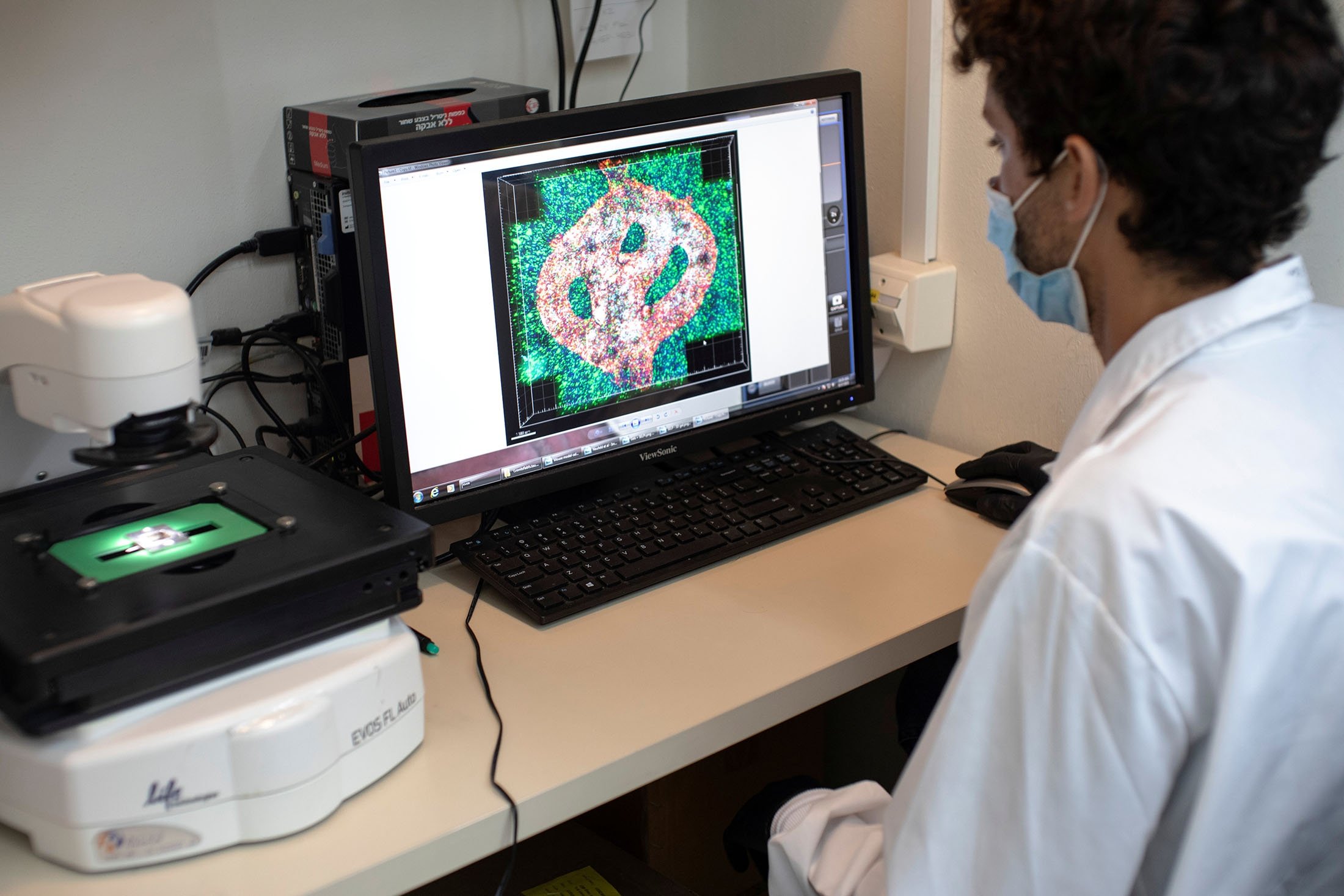 Israeli researcher Eilam Yeini examines a microscope image of a blood vessel tube surrounded by cancerous tissue, at Tel Aviv University, Israel, Aug. 17, 2021. (Reuters Photo)