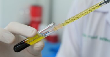 A healthy person can donate blood plasma up to 60 times a year. (Shutterstock Photo) 