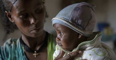 Ababa, 25, comforts her 6-month-old baby Wegahta, who was diagnosed as severely acutely malnourished, in Gijet, the Tigray region, northern Ethiopia, July 20, 2021. (AP Photo)