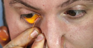 Artist Leandro Granato squirts paint from his eye onto a canvas at his studio in the Alejandro Korn town in greater Buenos Aires, Argentina, Oct.10, 2013. (REUTERS Photo)
