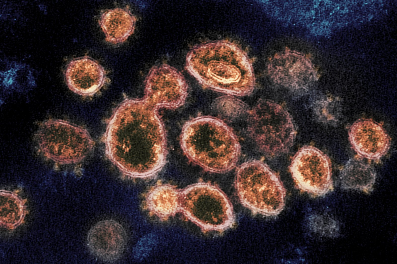 An electron microscope image shows SARS-CoV-2 virus particles which cause COVID-19, isolated from a patient in the U.S., emerging from the surface of cells cultured in a lab. (NIAID-RML via AP)