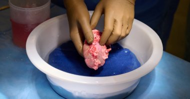 A genetically engineered pig kidney is cleaned and prepared for transplantation to a human at NYU Langone in New York, U.S. (Reuters Photo)