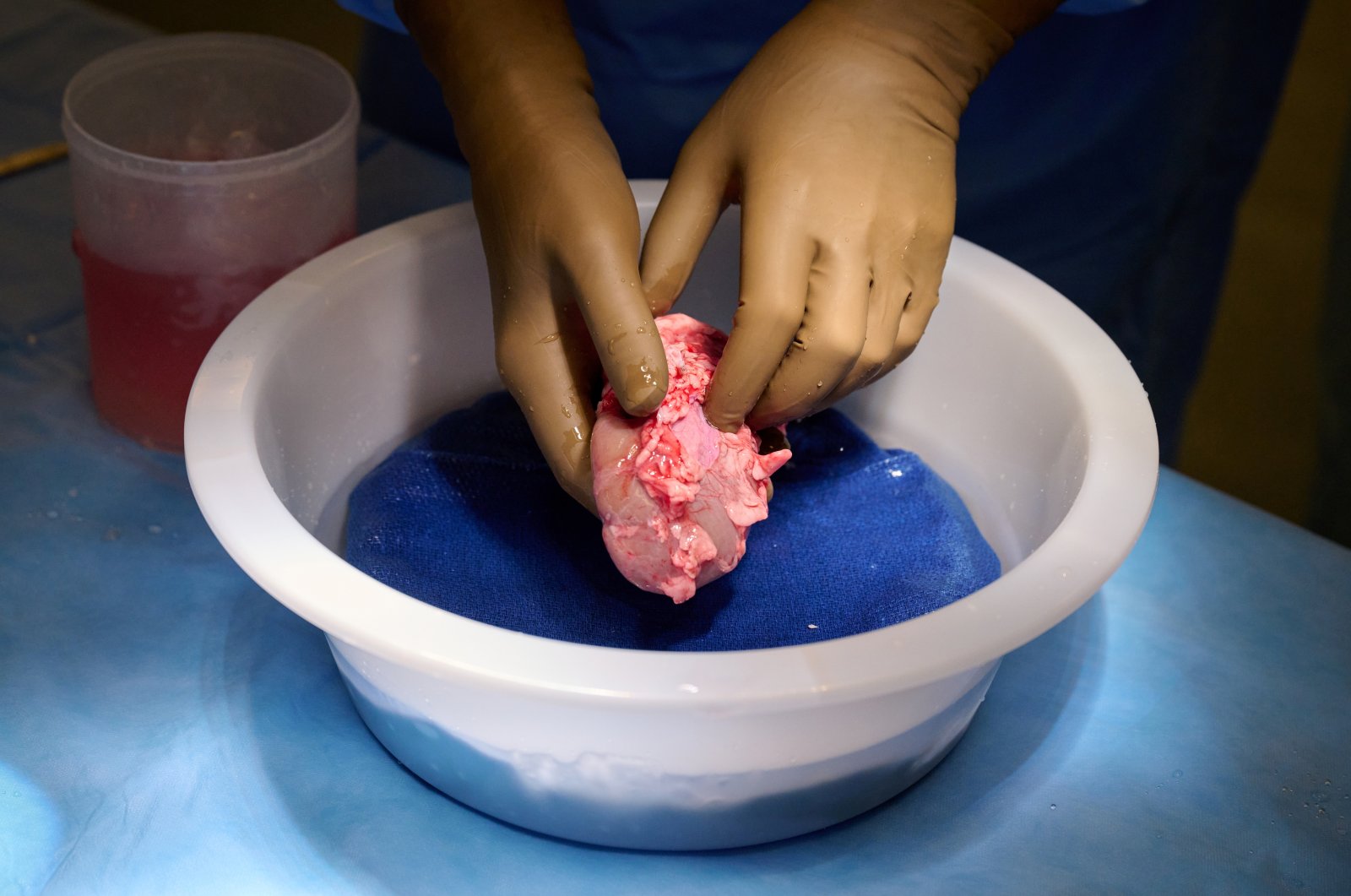 A genetically engineered pig kidney is cleaned and prepared for transplantation to a human at NYU Langone in New York, U.S. (Reuters Photo)