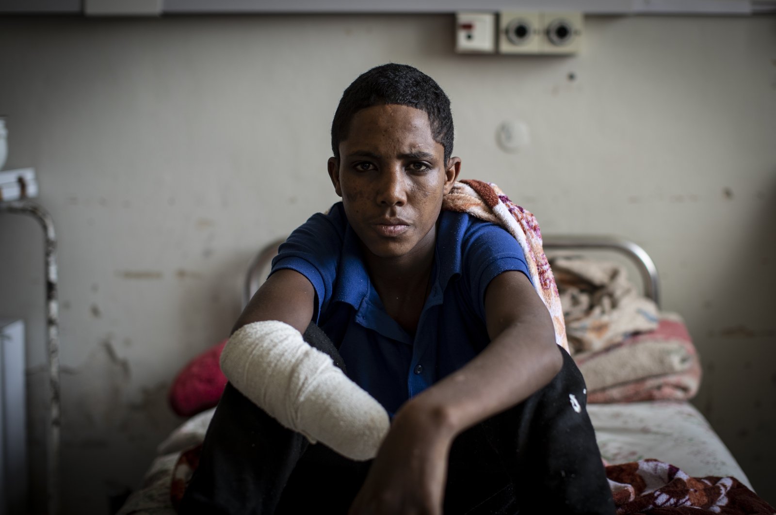 Haftom Gebretsadik, a 17-year-old from Freweini, Ethiopia, near Hawzen, who had his right hand amputated and lost fingers on his left after an artillery round struck his home in March, sits on his bed at the Ayder Referral Hospital in Mekele, in the Tigray region of northern Ethiopia, May 6, 2021. (AP Photo)