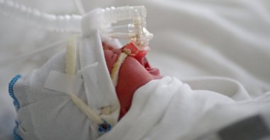 A newborn baby infected with COVID-19 receives oxygen at a maternity hospital in Volgograd, Russia, Aug. 19, 2021. (Reuters Photo)