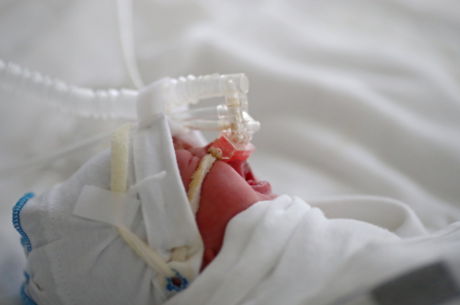 A newborn baby infected with COVID-19 receives oxygen at a maternity hospital in Volgograd, Russia, Aug. 19, 2021. (Reuters Photo)