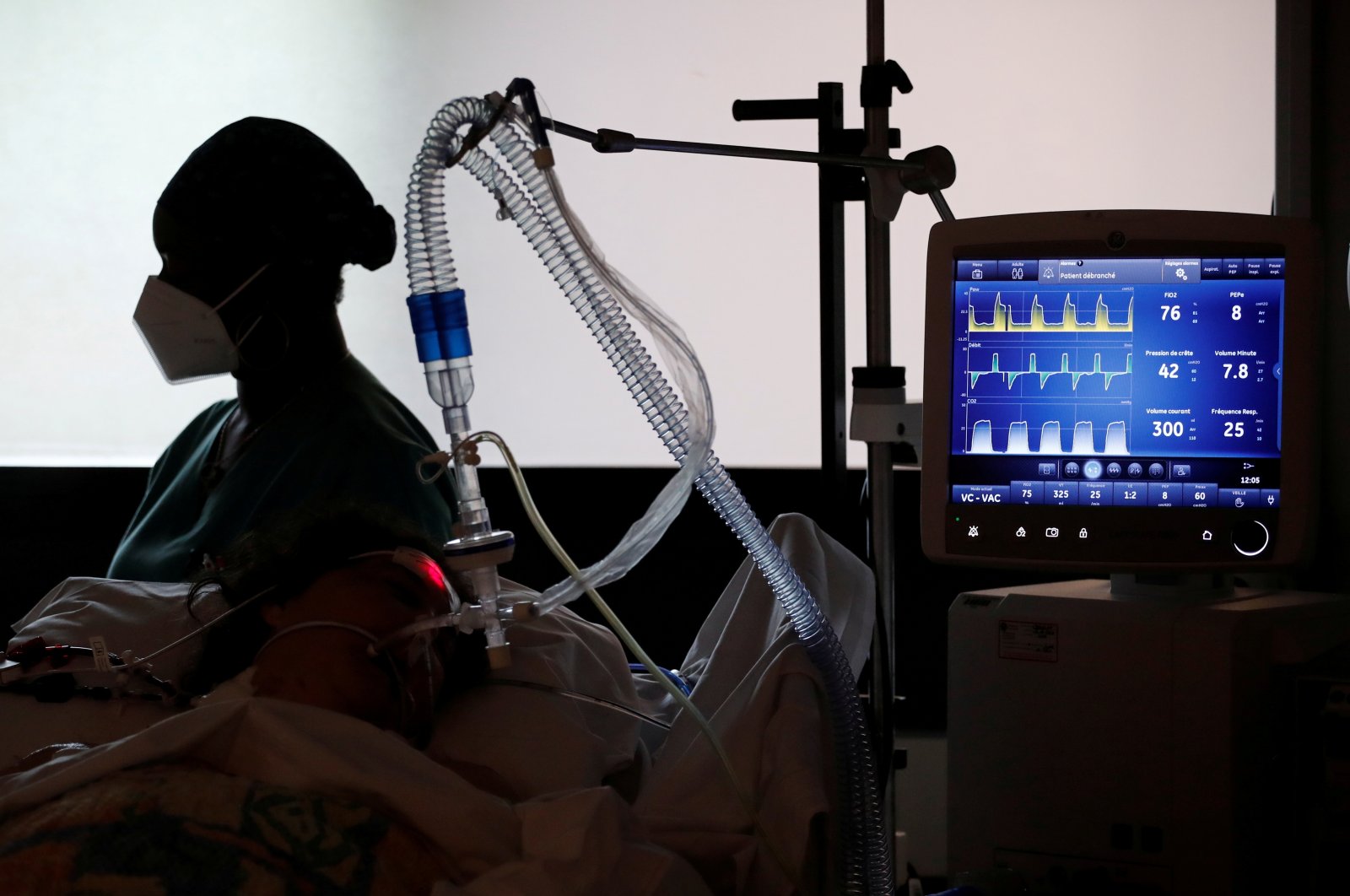A COVID-19 patient connected to a ventilator tube in the Intensive Care Unit (ICU) at the Centre Cardiologique du Nord private hospital in Saint-Denis, near Paris, amid the coronavirus pandemic in France, May 4, 2021. (Reuters Photo)