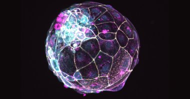 A human “blastoid” created in a lab. (Institute of Molecular Biology of the Austrian Academy of Sciences via AP)