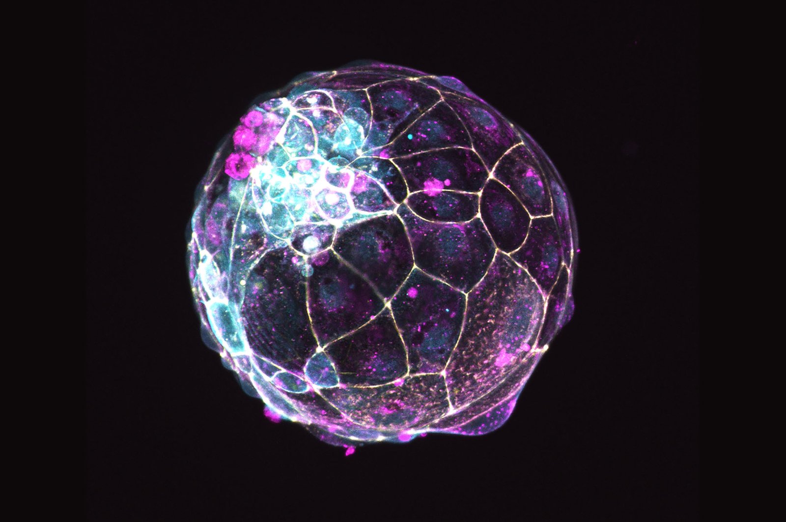 Satu langkah yang sangat kecil bagi manusia: Para ilmuwan mereplikasi pra-embrio