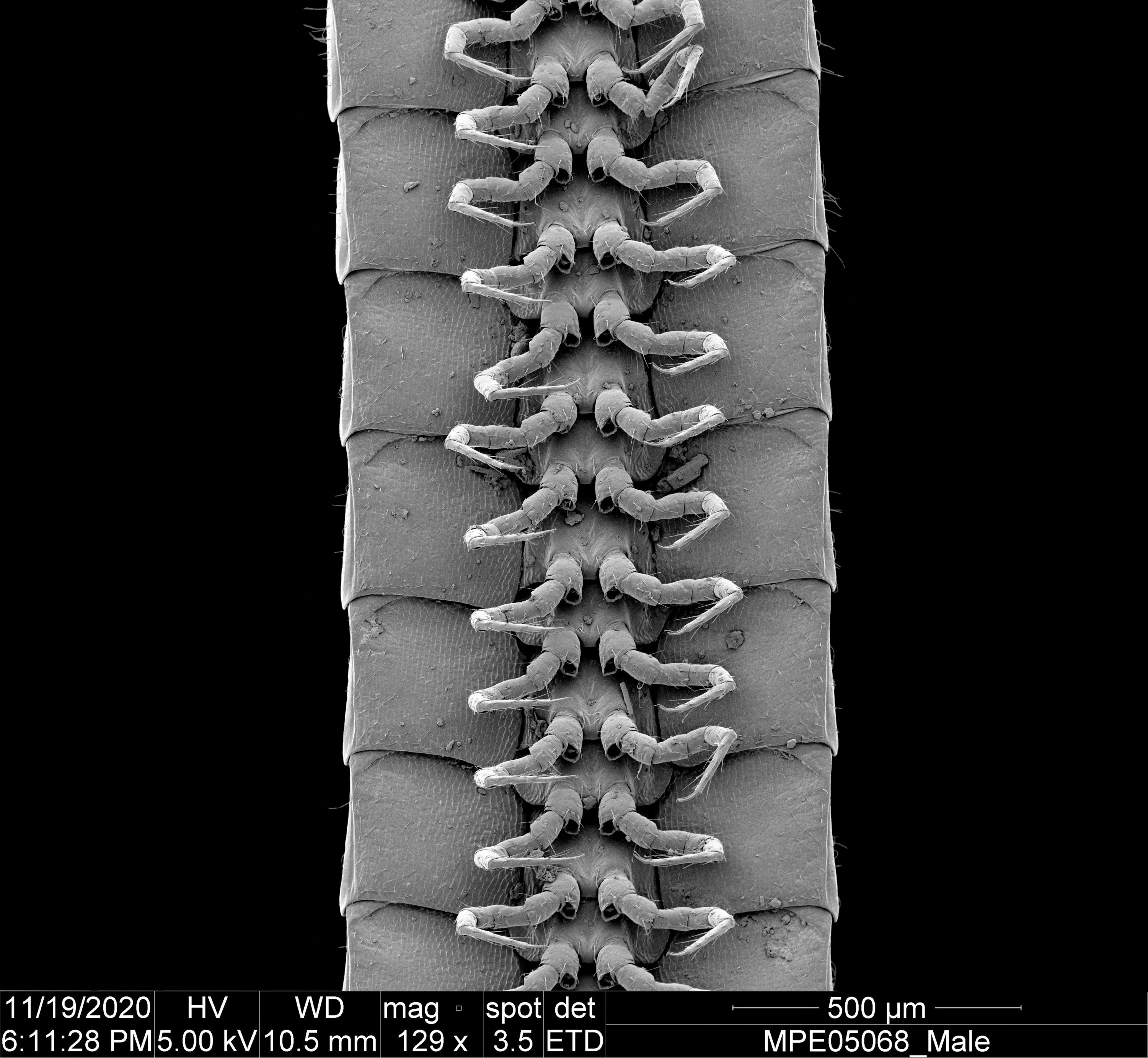 Sebuah pandangan mikroskopis dari kaki individu laki-laki dari spesies kaki seribu yang baru diidentifikasi Eumillipes persephone ditemukan jauh di bawah tanah di Australia.  (Foto Reuters)