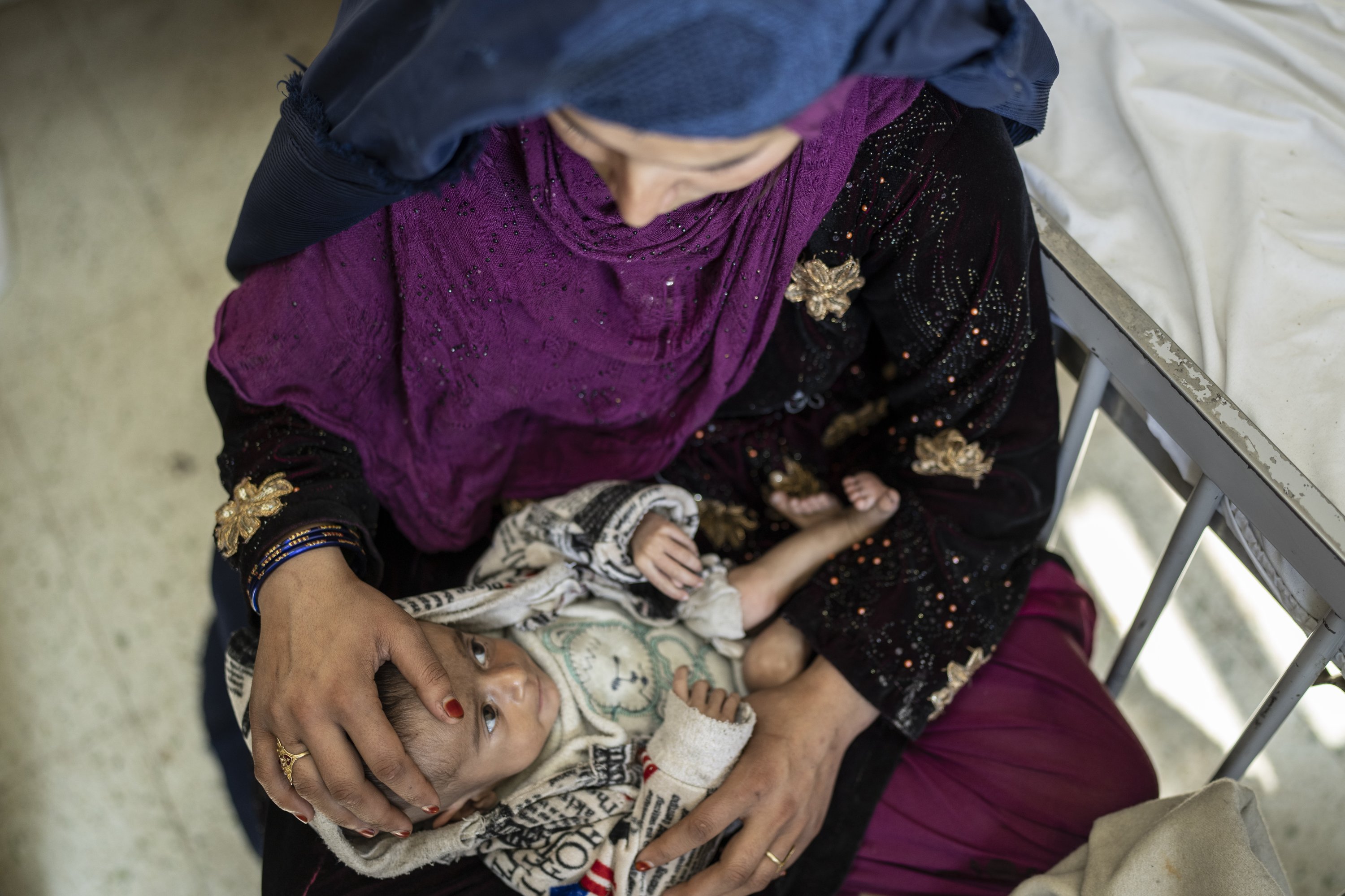 Saliha holds her 4-month-old baby Najeeb as he undergoes treatment at the malnutrition ward of the Indira Gandhi Children's Hospital in Kabul, Afghanistan, Dec. 8, 2021. (AP Photo)
