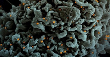 A colorized scanning electron micrograph of a cell (teal) infected with U.K. B.1.1.7 variant SARS-CoV-2 virus particles (orange), isolated from a patient sample, March 31, 2021. (National Institute of Allergy and Infectious Diseases via AFP)