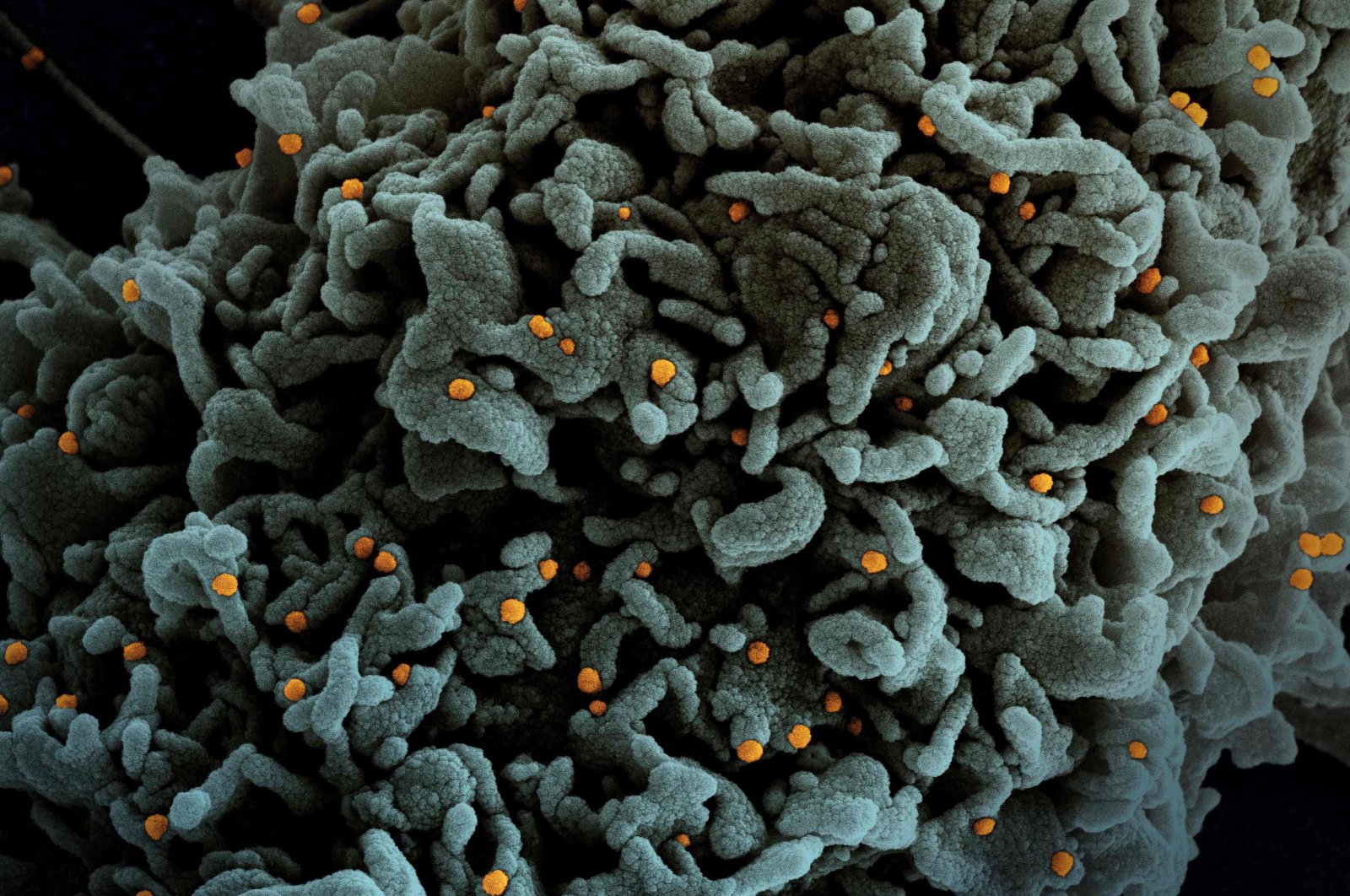 A colorized scanning electron micrograph of a cell (teal) infected with U.K. B.1.1.7 variant SARS-CoV-2 virus particles (orange), isolated from a patient sample, March 31, 2021. (National Institute of Allergy and Infectious Diseases via AFP)