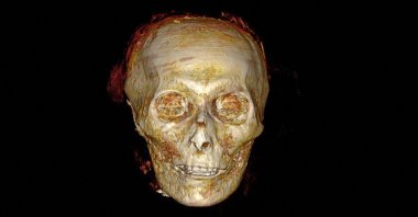 A 3D reconstruction of the head of Amenhotep I, created using computed tomography (CT) scans, Dec. 28, 2021. (Egypt&#039;s Tourism and Antiquities Ministry via AFP)