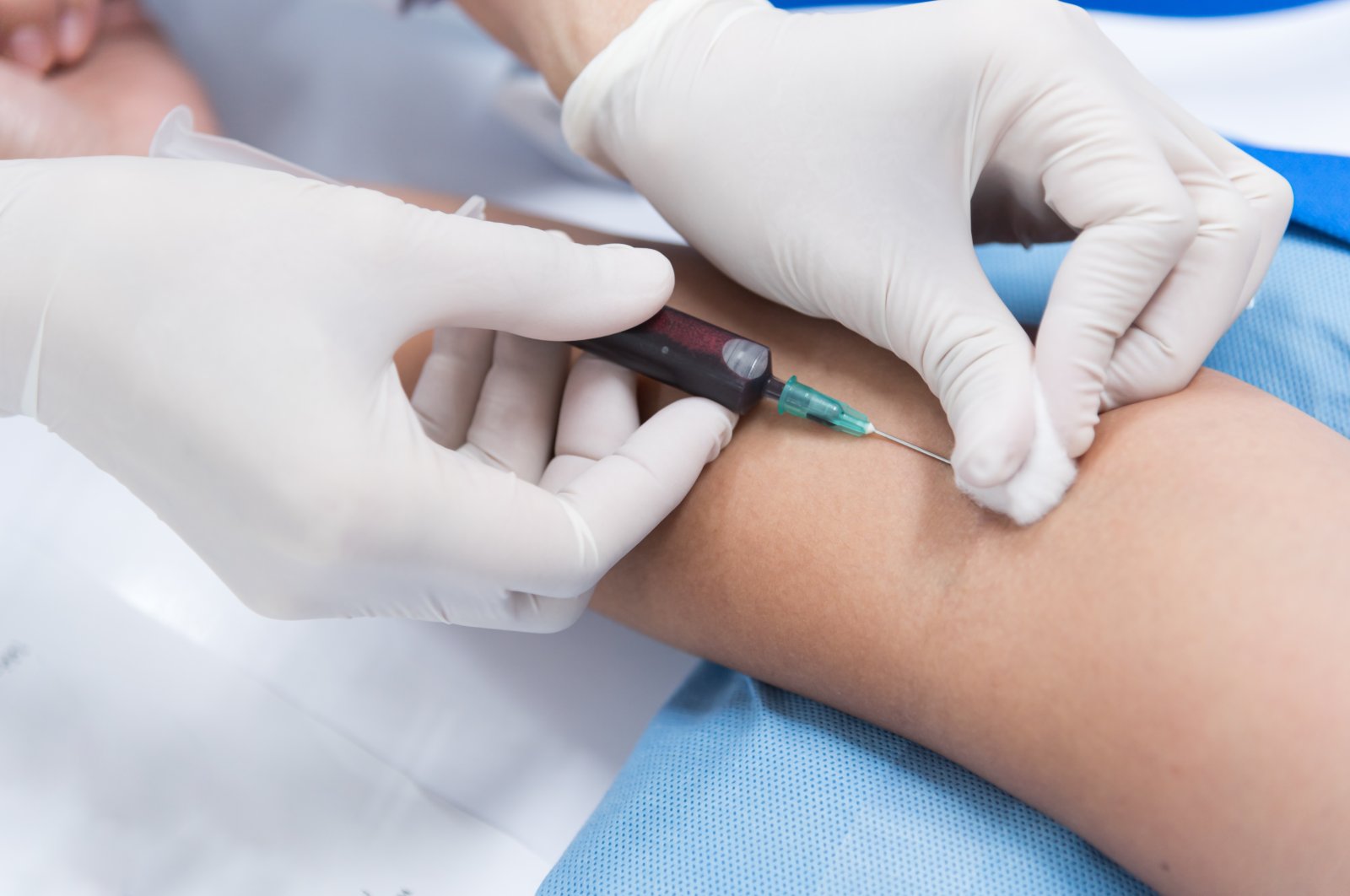 Terapi darah autologus: Apakah menyuntikkan kembali darah Anda sendiri bermanfaat?