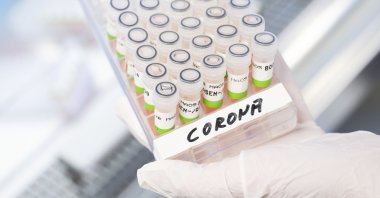 A biological-technical assistant shows prepared PCR tests for the Corona virus from patients in the PCR laboratory of the Lower Saxony State Health Office (NLGA) in Hannover, Germany, Jan. 5, 2022. (AP photo)