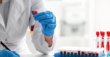 Everyone should be getting an annual medical checkup even if they are feeling alright. (Shutterstock Photo)