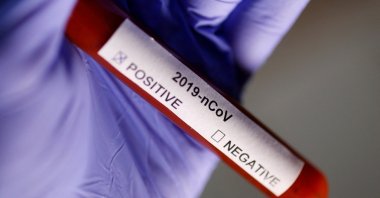 Test tube labeled COVID-19 positive is seen in this illustration, Jan. 29, 2020. (Reuters Photo)