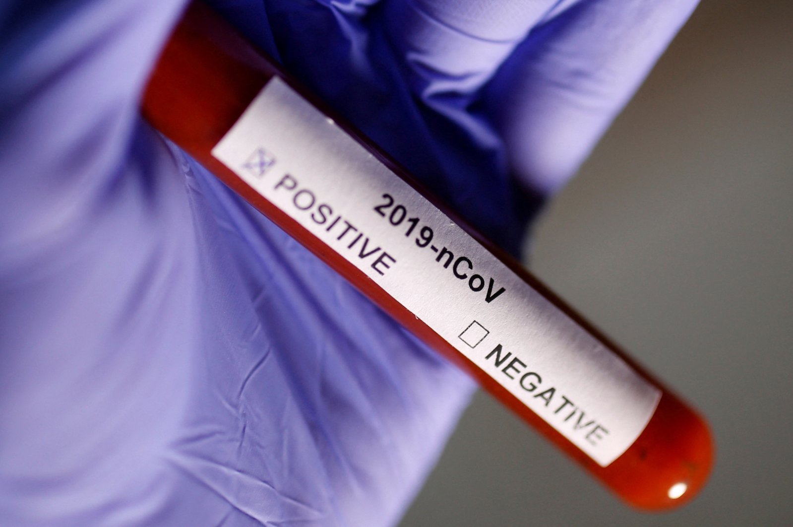 Test tube labeled COVID-19 positive is seen in this illustration, Jan. 29, 2020. (Reuters Photo)