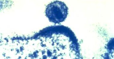 This 2012 colorized electron microscope image shows a single human immunodeficiency virus, center, as it was budding from a human immune cell, which the virus had infected, and within which the HIV virus had been replicated. (NIAID via AP)