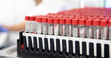 Samples of the coronavirus PCR gargle test are pictured before further examination in the LifeBrain laboratory in Vienna, Austria, Feb. 1, 2022. (AFP Photo)