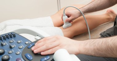 Acute deep vein thrombosis, or DVT, is a common condition that occurs in the legs of men and women of all ages. (Shutterstock Photo)