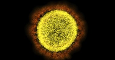 Electron microscope image shows a Novel Coronavirus SARS-CoV-2 particle isolated from a patient, in a laboratory in Fort Detrick, Maryland, U.S., 2020. (AP Photo)