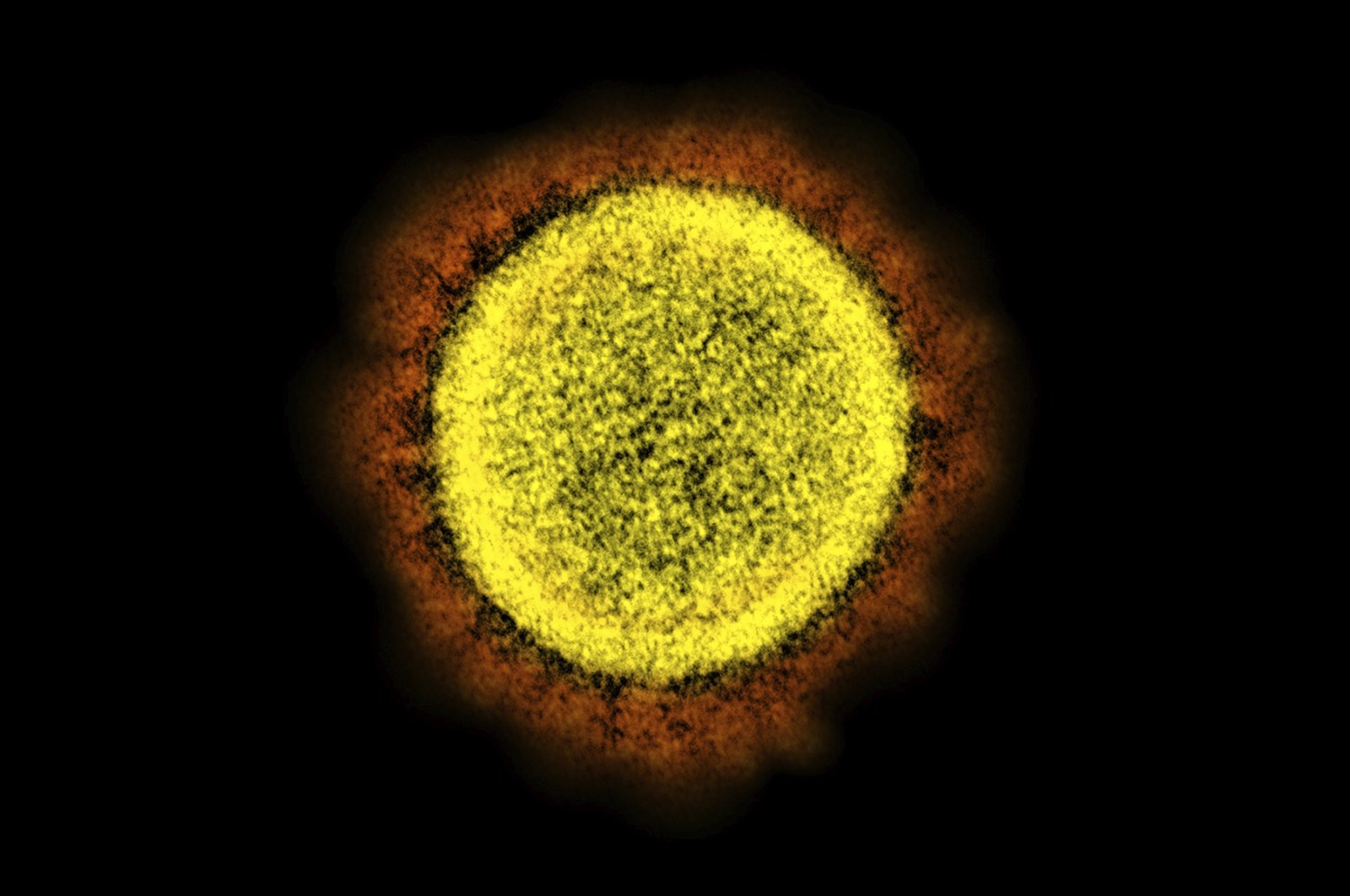 Electron microscope image shows a Novel Coronavirus SARS-CoV-2 particle isolated from a patient, in a laboratory in Fort Detrick, Maryland, U.S., 2020. (AP Photo)