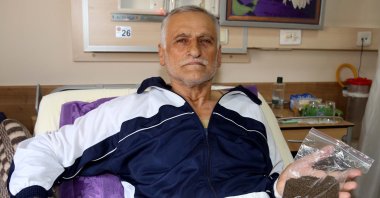 Kemal Doğru shows some kidney stones removed from his body, in Tokat, northern Turkey, Feb. 28, 2022. (AA Photo)