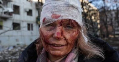 The photograph of Olena Kurilo taken by Anadolu Agency photojournalist Wolfgang Schwan in Kharkiv, Ukraine during the Russian military invasion. (AA Photo)
