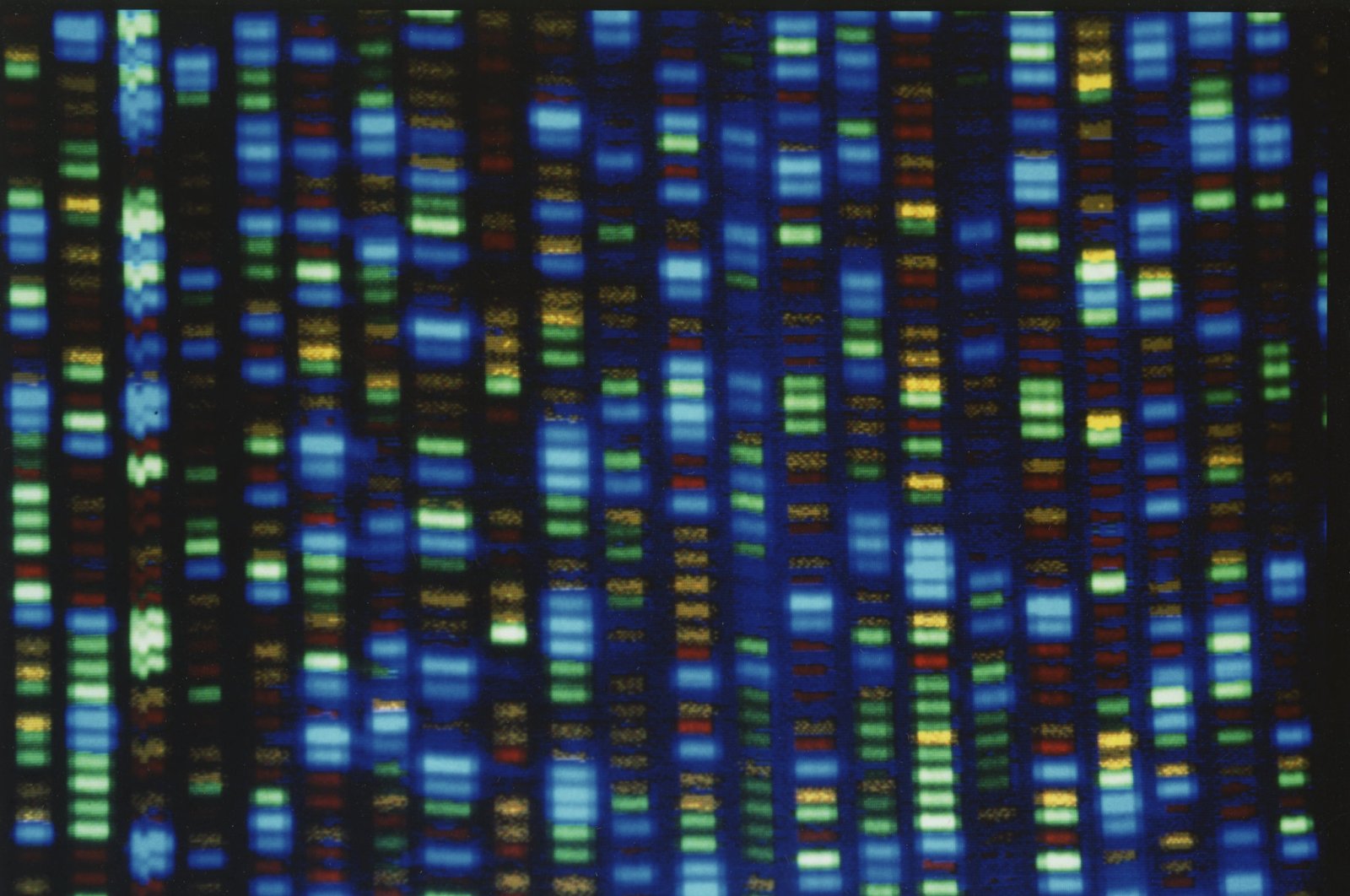 Output from a DNA sequencer is seen in this undated image made available by the National Human Genome Research Institute. (NHGRI via AP)