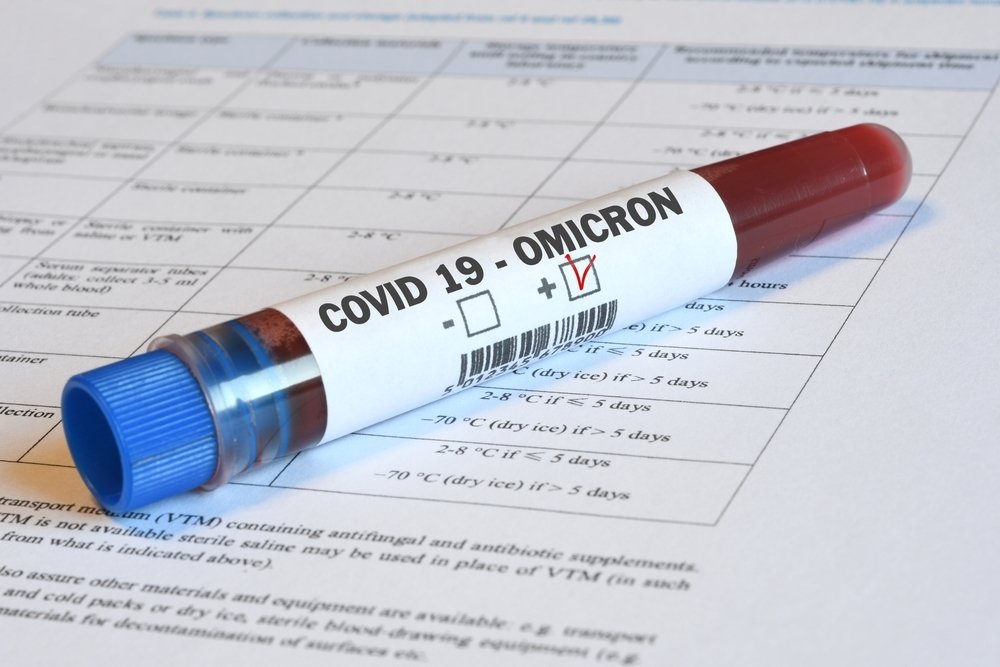 A vial of blood tested for the omicron COVID-19 variant. (Shutterstock Photo)