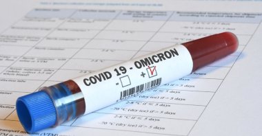A vial of blood tested for the omicron COVID-19 variant. (Shutterstock Photo)