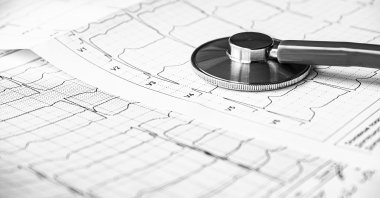 Heart attacks are more prevalent today than they were a couple of decades ago. (Shutterstock Photo)