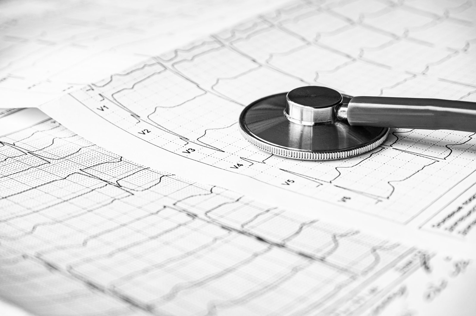 Heart attacks are more prevalent today than they were a couple of decades ago. (Shutterstock Photo)