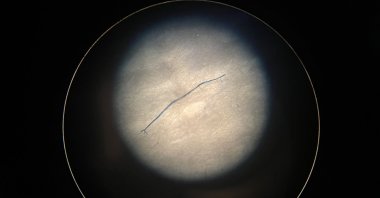 Microplastics can be seen at microscopic level, at Istanbul University, Istanbul, Turkey, April 18, 2022. (AA Photo)