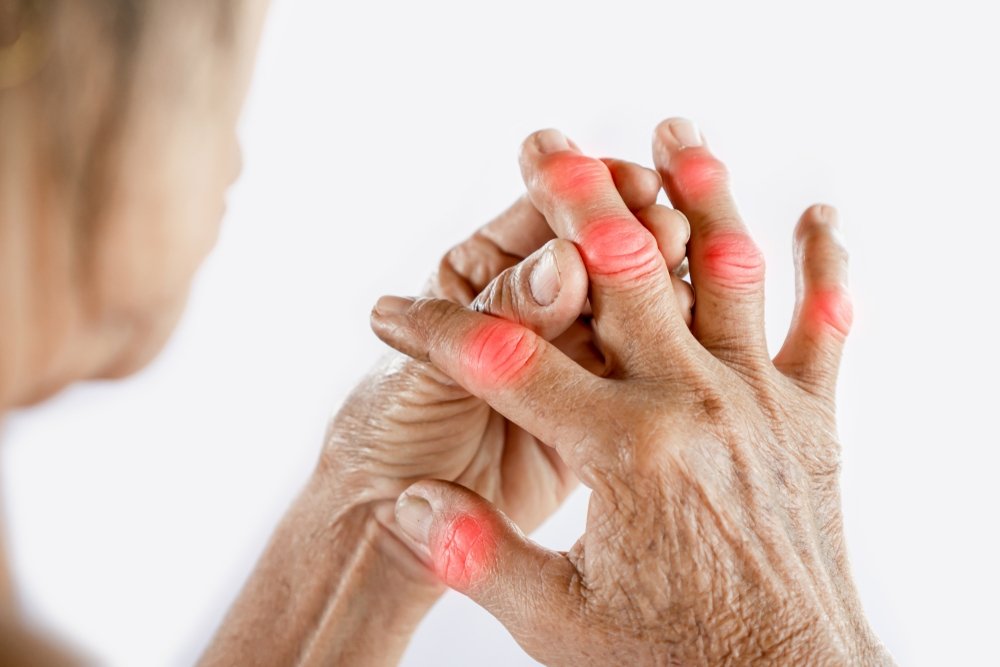 A woman massages her finger to relieve joint pain caused by gout, April 25, 2022. (Shutterstock Photo)