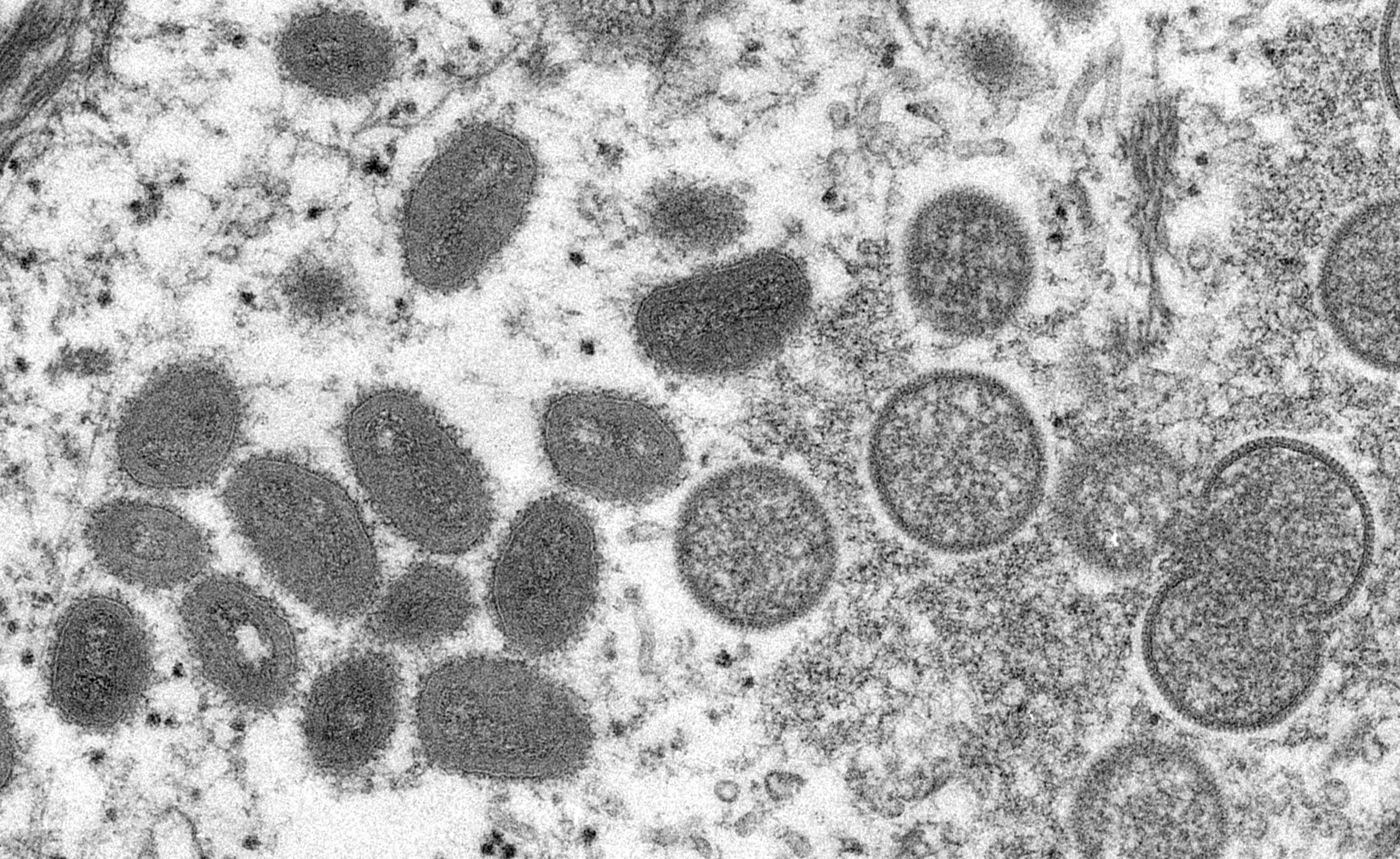 Gambar mikroskop elektron (EM) menunjukkan partikel virus monkeypox dewasa berbentuk oval serta sabit dan partikel bulat dari virion yang belum matang, diperoleh dari sampel kulit manusia klinis yang terkait dengan wabah anjing padang rumput tahun 2003 dalam gambar tidak bertanggal yang diperoleh Reuters, Mei 18, 2022. (Foto Reuters)