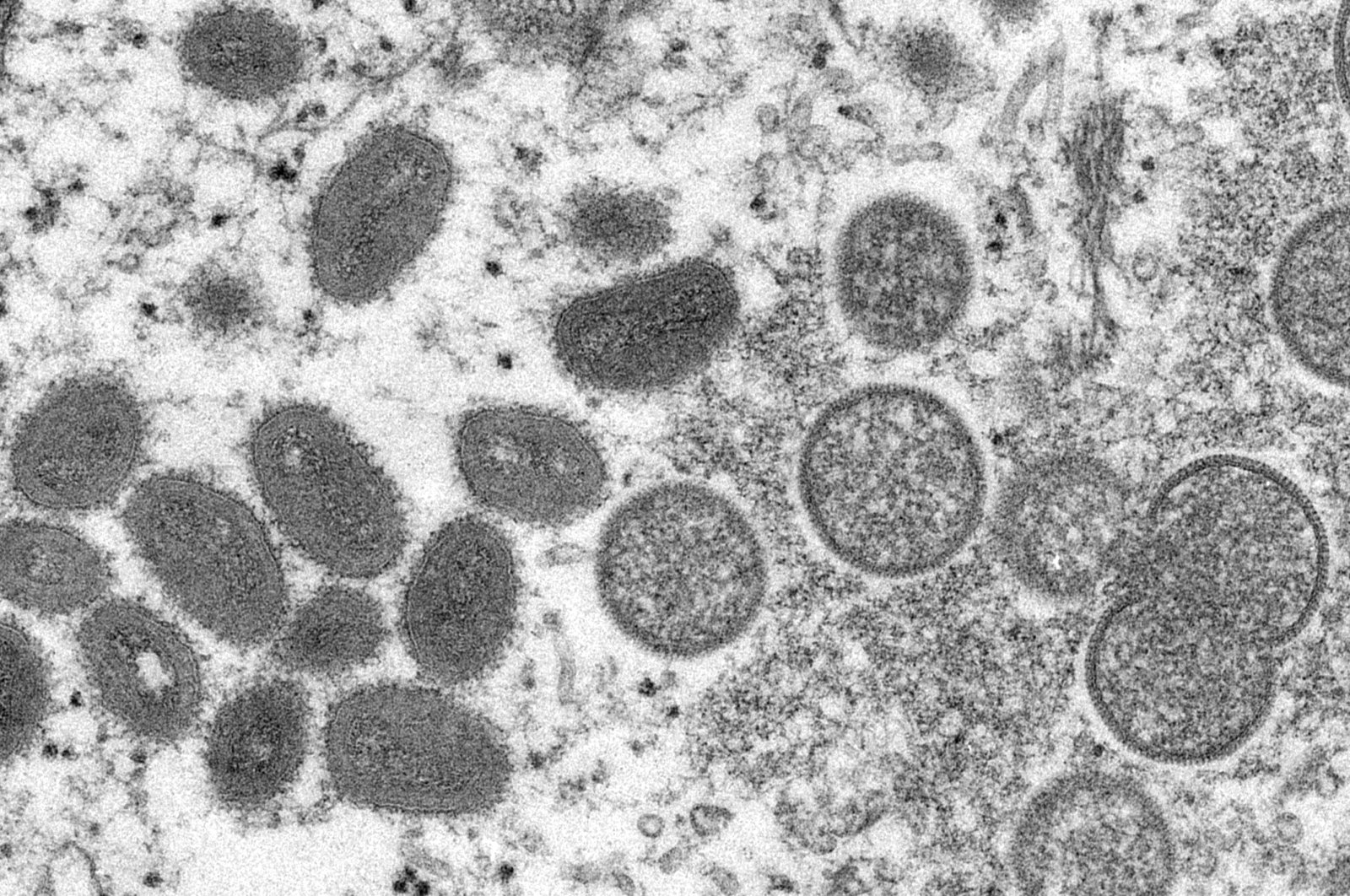 An electron microscope image shows mature, oval-shaped monkeypox virions (L), and spherical immature virions (R), obtained from a sample of human skin associated with the 2003 prairie dog outbreak. (CDC via AP)