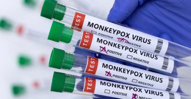 Test tubes labelled "Monkeypox virus positive and negative" are seen in this illustration taken May 23, 2022. (Reuters Photo)