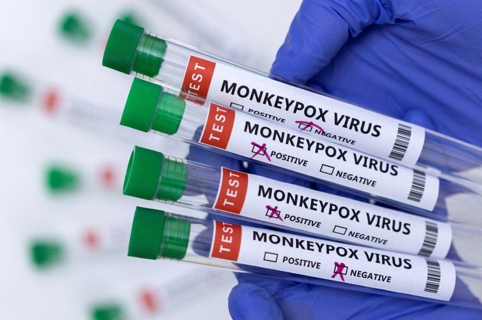 Test tubes labelled &quot;Monkeypox virus positive and negative&quot; are seen in this illustration taken May 23, 2022. (Reuters Photo)