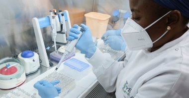 Aisha Mohammed, 31, a research associate at work in a lab at Yemaachi Biotechnology, a cancer research laboratory in Accra, Ghana, May 19, 2022. (Reuters Photo)