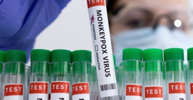 Test tubes labeled "Monkeypox virus positive" are seen in this illustration created May 23, 2022. (Reuters Photo)