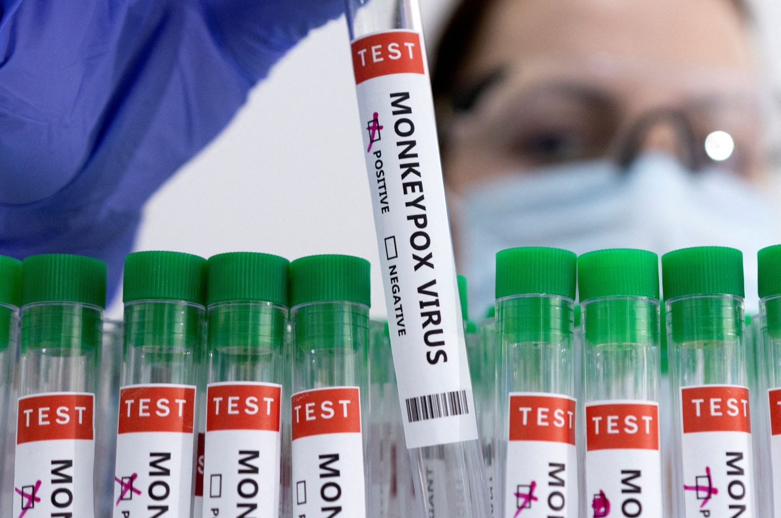 Test tubes labeled "Monkeypox virus positive" are seen in this illustration created May 23, 2022. (Reuters Photo)