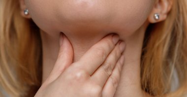 Experts say that long-term hoarseness may indicate important health problems. (Shutterstock Photo)